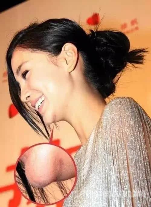 Angelababy下巴突出