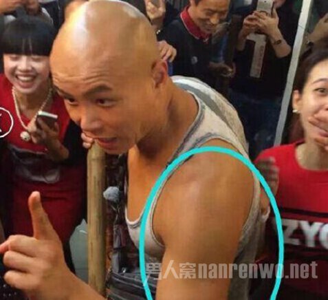 乐嘉证实自己睾丸受伤