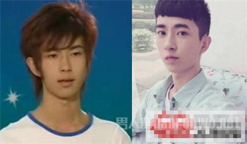 于朦胧整容前后对比照